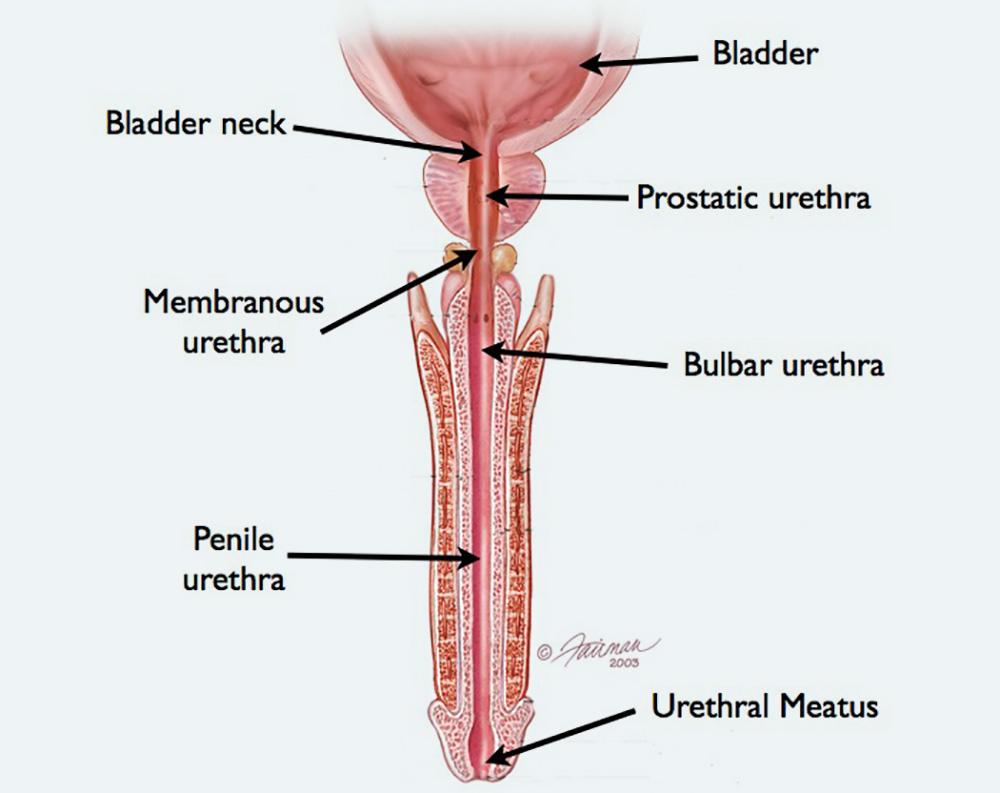 Used with permission of the American Urological Association (AUA)