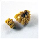 Managing Stones in the Kidney & Ureter