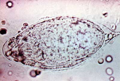 Bilharzia egg