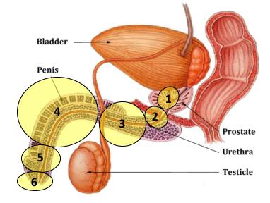 Used with permission of the American Urological Association (AUA)