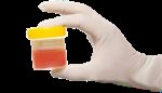Haematuria Guidelines