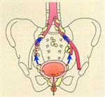 Prostate Cancer MDT