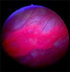 Briefing Paper on Biomarkers